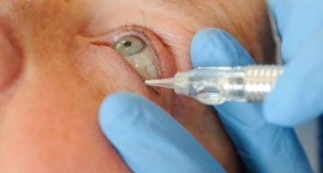 Nieuwsbericht: Permanente Eyeliner
